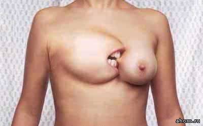 400x249, 9 Kb / укус