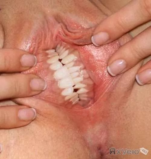 500x526, 32 Kb / вагина, зубы