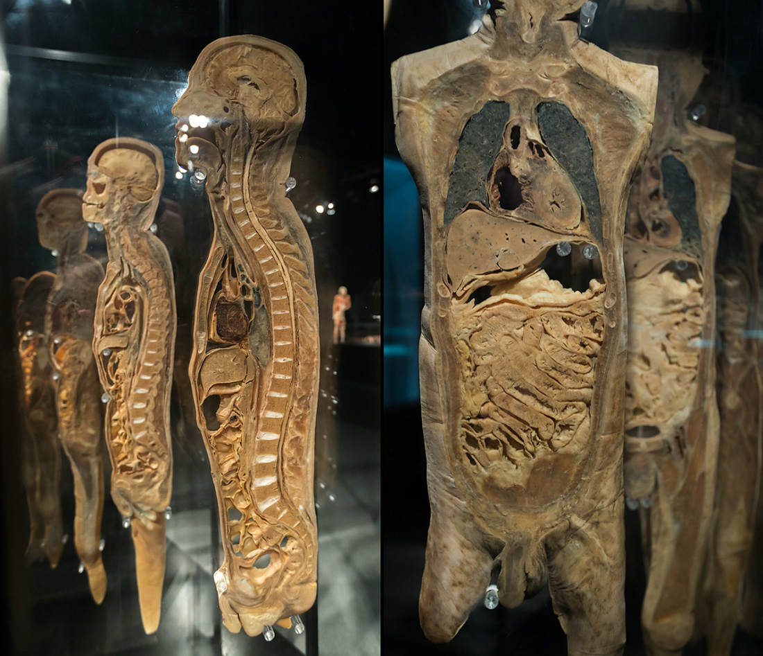 1100x947, 376 Kb / скульптура, человек, тело, стекло