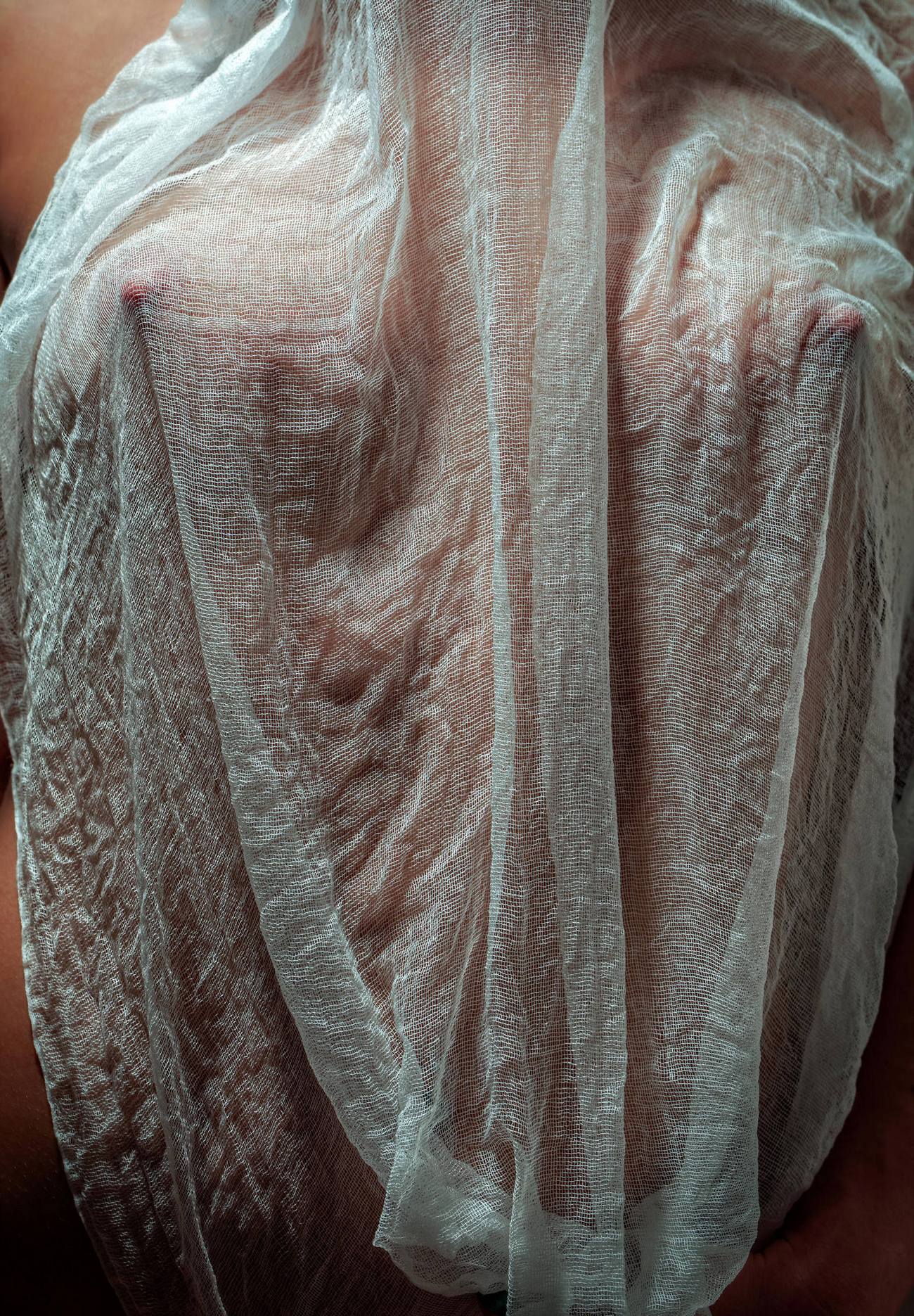 1300x1871, 618 Kb / сетка, марля, Марк Бергманн