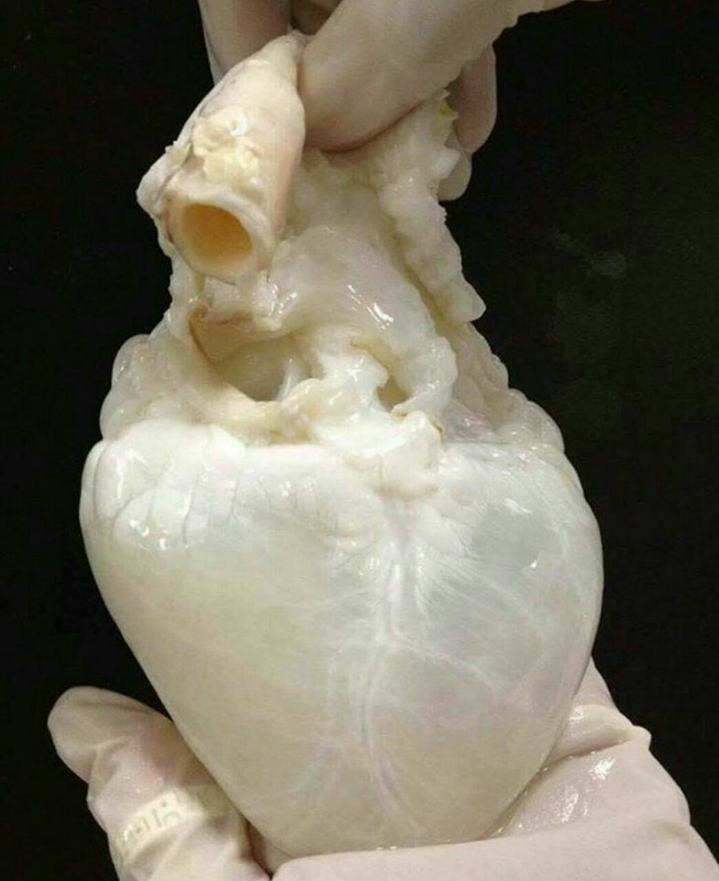 1045x1280, 94 Kb / сердце, трансплантация, донор