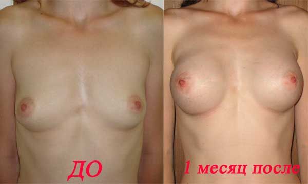 600x360, 17 Kb / грудь