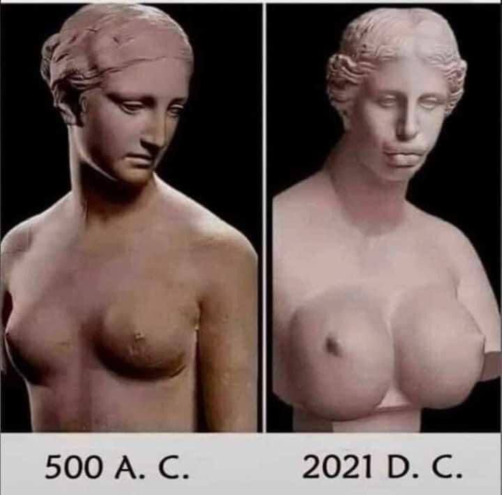 720x709, 30 Kb / Бюст, силикон, ботекс