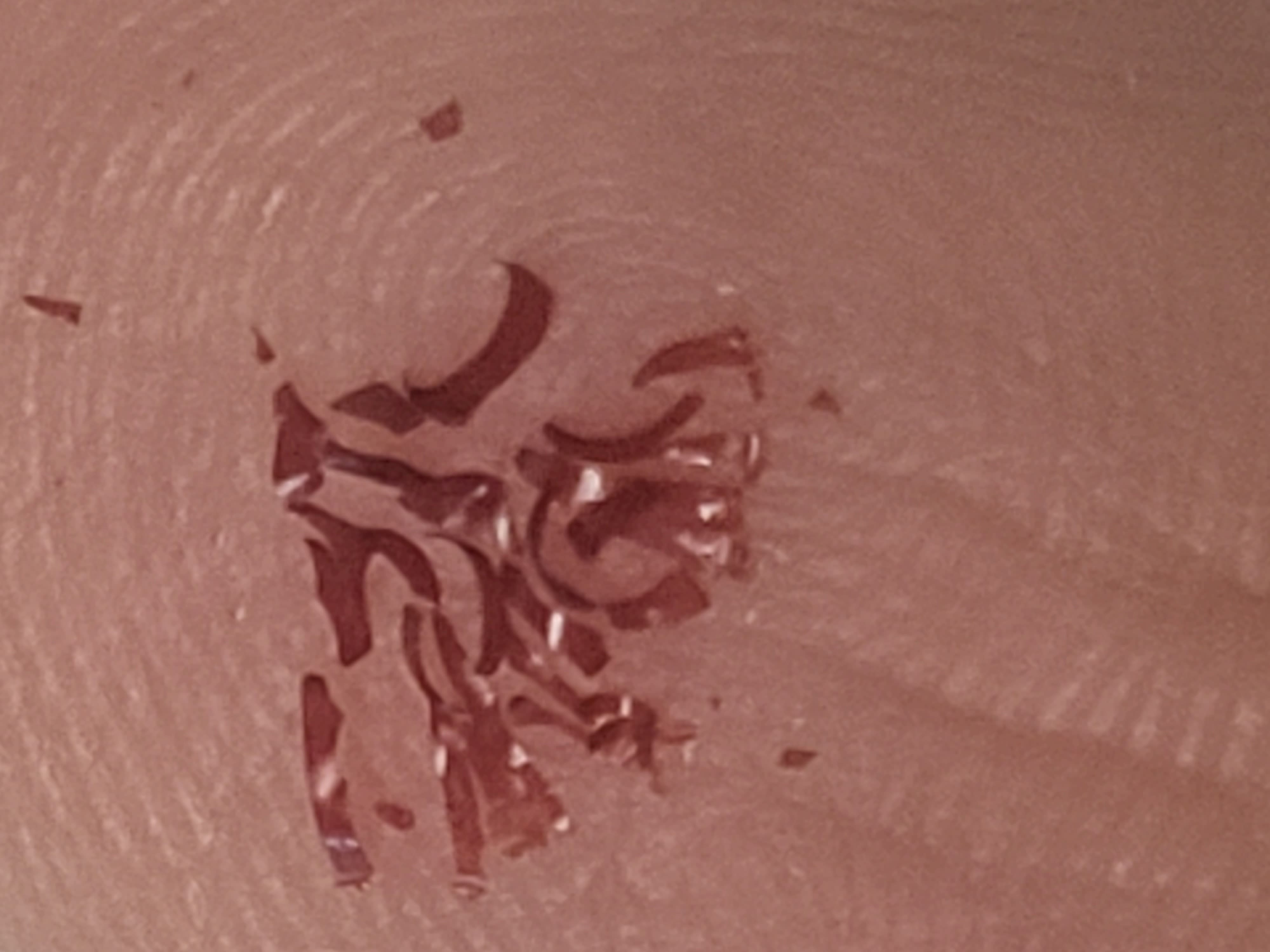 4000x3000, 242 Kb / узор, палец, кровь, Pana