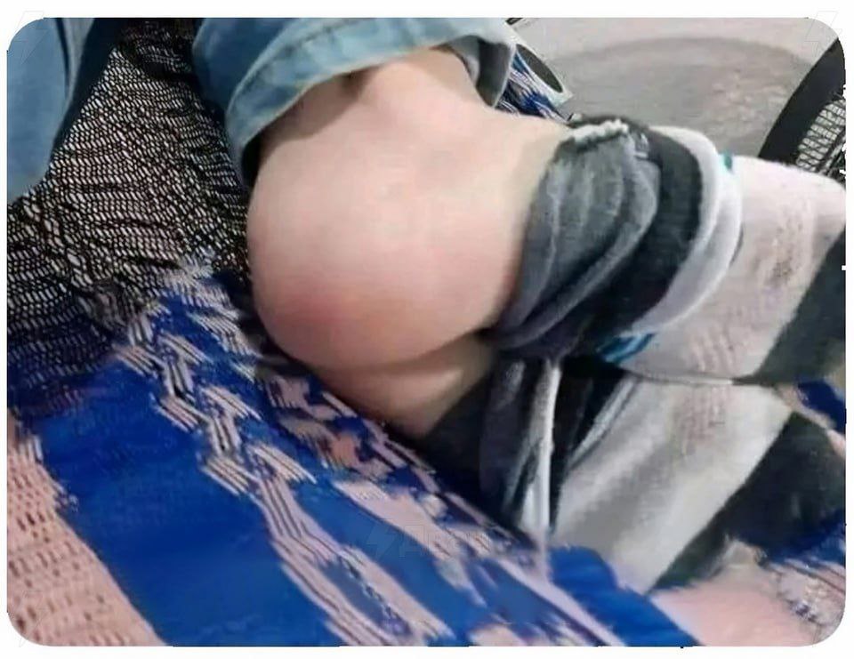 960x741, 102 Kb / Пятка, носок, не сразу