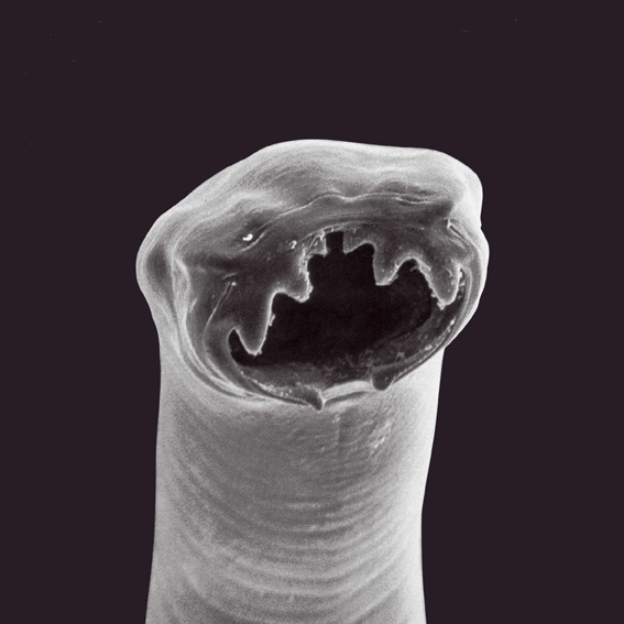 567x567, 71 Kb / стронгилоидоз