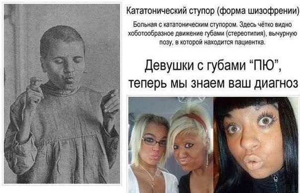 604x389, 36 Kb / губы, тп, ступор, шизофрения, дакфейс, duckface