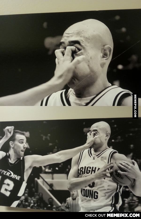 600x930, 63 Kb / баскетбол, пальцы, глазницы