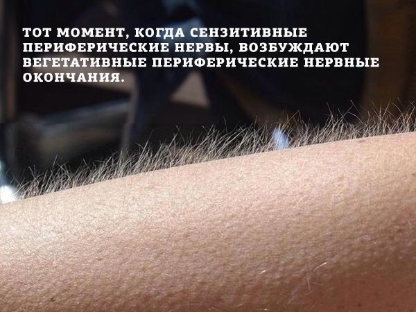 600x450, 66 Kb / кожа, волосы, дыбом, макро, умничание