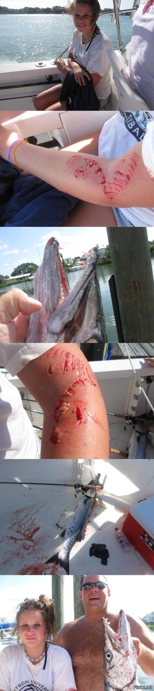 500x2234, 212 Kb / Рыбалка, раны, баракуда