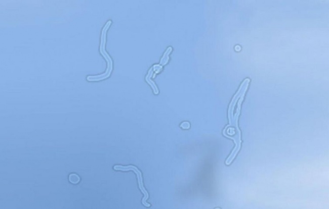 650x414, 25 Kb / Плавающие, мушки, глаз