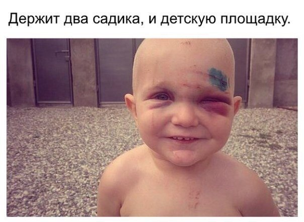 604x442, 51 Kb / пацан, ребёнок, фингал, синяк