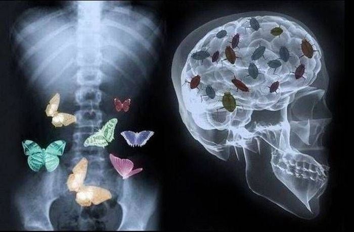 700x460, 53 Kb / рентген, бабочки, тараканы